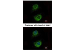 ICC/IF Image Immunofluorescence analysis of methanol-fixed HeLa, using HSP70 1B, antibody at 1:500 dilution.