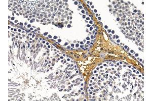 ABIN6260161 and ABIN6279063 at 1/100 staining rat testis tissue by IHC-P. (AWAT2 anticorps  (Internal Region))
