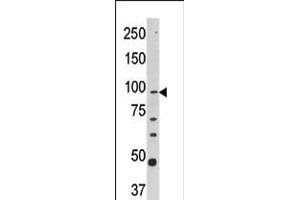 Western blot analysis of anti-CPT1A Pab in Y79 cell line lysate (35ug/lane). (CPT1A anticorps  (C-Term))