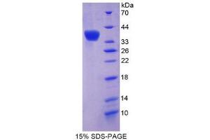 SDS-PAGE (SDS) image for Olfactomedin 4 (OLFM4) (AA 238-500) protein (His tag) (ABIN1080403)