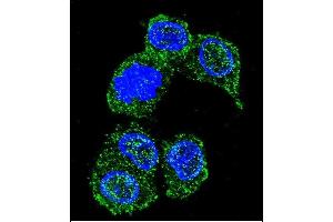 Confocal immunofluorescent analysis of PK8 Antibody (C-term) (ABIN391724 and ABIN2841613) with HepG2 cell followed by Alexa Fluor 488-conjugated goat anti-rabbit lgG (green). (JNK anticorps  (C-Term))