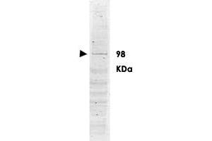 Western blot using POLK polyclonal antibody  shows detection ofa band ~98 KDa corresponding to human POLK (arrowhead).