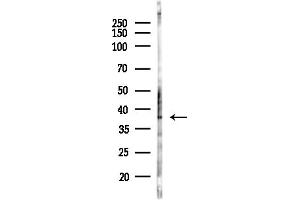 anti-G Protein-Coupled Receptor 119 (GPR119) (Internal Region) antibody