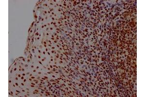 IHC image of ABIN7127545 diluted at 1:100 and staining in paraffin-embedded human tonsil tissue performed on a Leica BondTM system. (Recombinant HMGB1 anticorps)