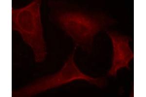 Immunofluorescence staining of methanol-fixed Hela cells using MEK1(Phospho-Ser221) Antibody.