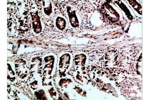 Immunohistochemical analysis of paraffin-embedded human-colon, antibody was diluted at 1:200 (VHL anticorps  (AA 1-50))