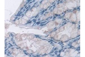 Detection of NQO1 in Mouse Colon Tissue using Polyclonal Antibody to NADH Dehydrogenase, Quinone 1 (NQO1)