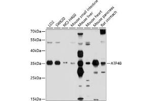 Western blot analysis of extracts of various cell lines, using B antibody (ABIN6130981, ABIN6137322, ABIN6137323 and ABIN6214233) at 1:1000 dilution. (ATP4b anticorps  (AA 62-291))