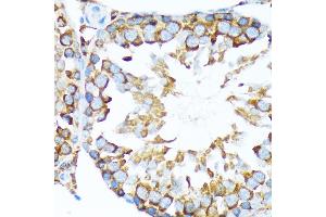 Immunohistochemistry of paraffin-embedded rat testis using STIP1 Rabbit mAb (ABIN1512566, ABIN3020619, ABIN3020620 and ABIN7101303) at dilution of 1:100 (40x lens). (STIP1 anticorps)