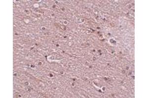 Immunohistochemistry (IHC) image for anti-Anoctamin 2 (ANO2) (N-Term) antibody (ABIN1031629) (Anoctamin 2 anticorps  (N-Term))