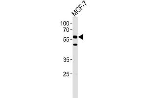 Western Blotting (WB) image for anti-Cell Division Cycle 7 (CDC7) antibody (ABIN3003260) (CDC7 anticorps)
