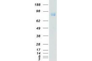 Validation with Western Blot