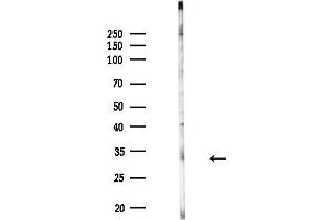 anti-Nogo B Receptor (NUS1) (Internal Region) antibody