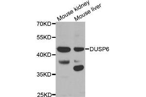 Western blot analysis of extracts of various tissues, using DUSP6 antibody. (DUSP6 anticorps  (AA 1-170))