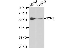 Western blot analysis of extracts of various cell lines, using STK11 antibody (ABIN5971149) at 1/1000 dilution. (LKB1 anticorps)