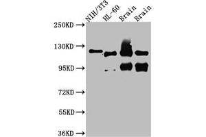 Western Blot Positive WB detected in: NIH/3T3 whole cell lysate, HL-60 whole cell lysate, Rat Brain whole cell lysate, Mouse Brain whole cell lysate All lanes: OGT antibody at 1:1000 Secondary Goat polyclonal to rabbit IgG at 1/50000 dilution Predicted band size: 117, 104, 116, 75 kDa Observed band size: 117 kDa (Recombinant OGT anticorps)