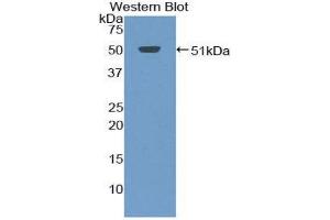 Western Blotting (WB) image for anti-Tumor Necrosis Factor Receptor Superfamily, Member 13C (TNFRSF13C) (AA 3-175) antibody (ABIN3208905) (TNFRSF13C anticorps  (AA 3-175))