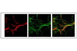MLC1 antibody used at a dilution of 1:50 to detect rat astrocytes. (MLC1 anticorps  (Middle Region))