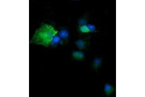 Image no. 4 for anti-Deleted in Primary Ciliary Dyskinesia Homolog (DPCD) antibody (ABIN1497889) (DPCD anticorps)