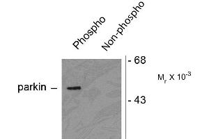 Western blots of HEK293 cells transfected with Parkin WT (Phospho) and Parkin S378 mutant (non-phospho) showing the phospho-specific immunolabeling of the ~ 52 k parkin protein. (Parkin anticorps  (pSer378))