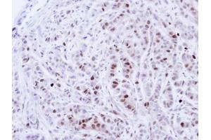 IHC-P Image Immunohistochemical analysis of paraffin-embedded A549 Xenograft, using NEK4, antibody at 1:100 dilution.