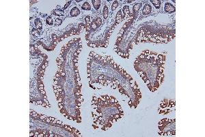 IHC analysis of DDR1 using anti-DDR1 antibody (ABIN7601407). (DDR1 anticorps  (AA 341-909))