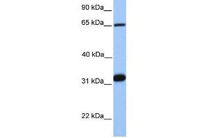 WB Suggested Anti-SF1  Antibody Titration: 0. (Splicing Factor 1 anticorps  (C-Term))