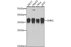 Western blot analysis of extracts of various cell lines, using SMN2 Rabbit pAb (ABIN6127949, ABIN6148136, ABIN6148139 and ABIN6218739) at 1:1000 dilution. (SMN2 anticorps  (AA 1-197))
