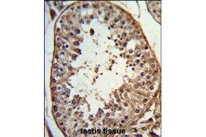 Formalin-fixed and paraffin-embedded human testis tissue reacted with ANGEL1 Antibody , which was peroxidase-conjugated to the secondary antibody, followed by DAB staining. (ANGEL1 anticorps  (C-Term))