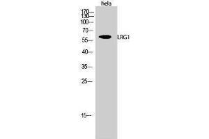 Western Blotting (WB) image for anti-Leucine-Rich alpha-2 Glycoprotein 1 (LRG1) (C-Term) antibody (ABIN3185409)