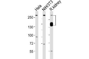 All lanes : Anti-SPTAN1 Antibody (Center) at 1:1000 dilution Lane 1: Hela whole cell lysates Lane 2: NIH/3T3 whole cell lysates Lane 3: rat kidney lysates Lysates/proteins at 20 μg per lane.