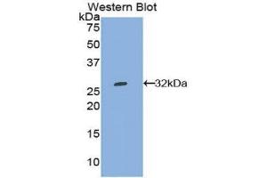 Western Blotting (WB) image for anti-Tryptophanyl-tRNA Synthetase (WARS) (AA 247-458) antibody (ABIN1860957) (WARS anticorps  (AA 247-458))