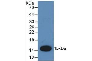 Detection of Recombinant MCP1, Rat using Polyclonal Antibody to Monocyte Chemotactic Protein 1 (MCP1) (CCL2 anticorps  (AA 24-148))