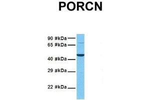 Host:  Rabbit  Target Name:  PORCN  Sample Tissue:  Human Hela  Antibody Dilution:  1.