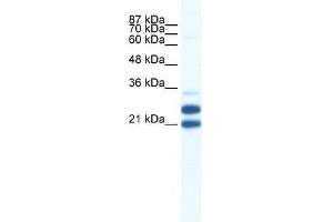 TRIM34 antibody used at 0. (TRIM34 anticorps  (N-Term))