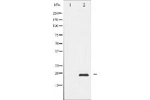 Western blot analysis of Stathmin 1 phosphorylation expression in PMA treated Jurkat whole cell lysates,The lane on the left is treated with the antigen-specific peptide.