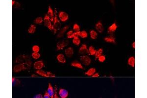 Immunofluorescence analysis of HeLa cells using NFE2L1 Polyclonal Antibody at dilution of 1:100. (NFE2L1 anticorps)