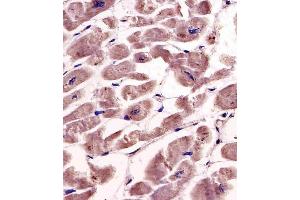 Antibody staining SPHK1 in human heart tissue sections by Immunohistochemistry (IHC-P - paraformaldehyde-fixed, paraffin-embedded sections). (SPHK1 anticorps  (AA 286-315))