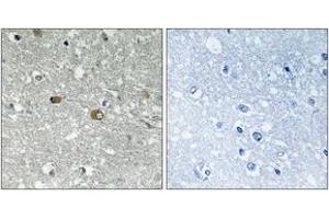 Immunohistochemistry analysis of paraffin-embedded human brain tissue, using PIGH Antibody. (PIGH anticorps  (AA 137-186))