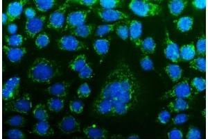IF analysis of CHCHD10 using anti-CHCHD10 antibody (ABIN7602507). (CHCHD10 anticorps  (AA 80-142))