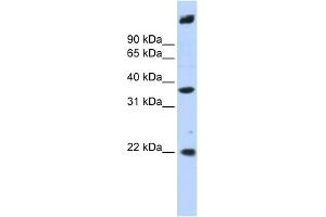 WB Suggested Anti-SSBP3 Antibody Titration: 0. (SSBP3 anticorps  (Middle Region))