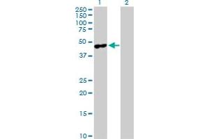 Western Blot analysis of MAGEA4 expression in transfected 293T cell line by MAGEA4 MaxPab polyclonal antibody. (MAGEA4 anticorps  (AA 1-317))