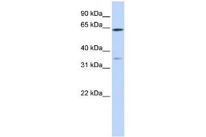 WB Suggested Anti-TRIM45 Antibody Titration:  0. (TRIM45 anticorps  (Middle Region))
