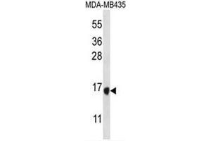 TAC4 Antibody (C-term) western blot analysis in MDA-MB435 cell line lysates (35µg/lane). (Tachykinin 4 anticorps  (C-Term))
