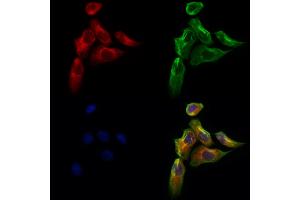 ABIN6260974 and ABIN6273103 staining Hela cells by IF/ICC. (Coq7 anticorps  (Internal Region))