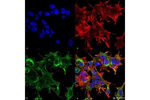 Immunocytochemistry/Immunofluorescence analysis using Mouse Anti-GFAP R416WT Monoclonal Antibody, Clone S206B-9 . (GFAP anticorps  (AA 411-422) (Atto 594))