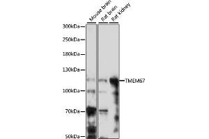 Western blot analysis of extracts of various cell lines, using TMEM67 antibody (ABIN7270970) at 1:1000 dilution.
