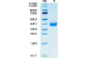 Biotinylated Cynomolgus CD161 on Tris-Bis PAGE under reduced condition. (CD161 Protein (AA 67-227) (His-Avi Tag,Biotin))
