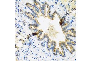 Immunohistochemistry of paraffin-embedded rat lung using DEFB4A antibody at dilution of 1:100 (40x lens).