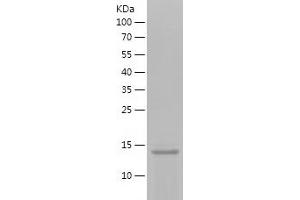 KiSS-1 Metastasis-Suppressor (KISS1) (AA 20-110) protein (His tag)